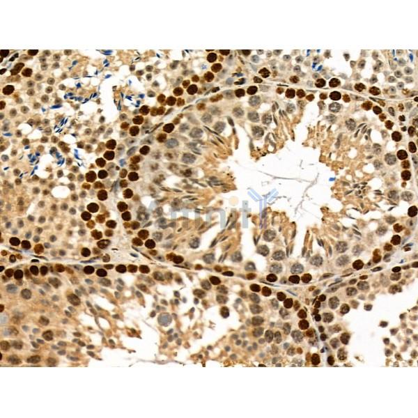 USP30 Antibody - DF4590 at 1/100 staining Mouse testis tissue by IHC-P.
