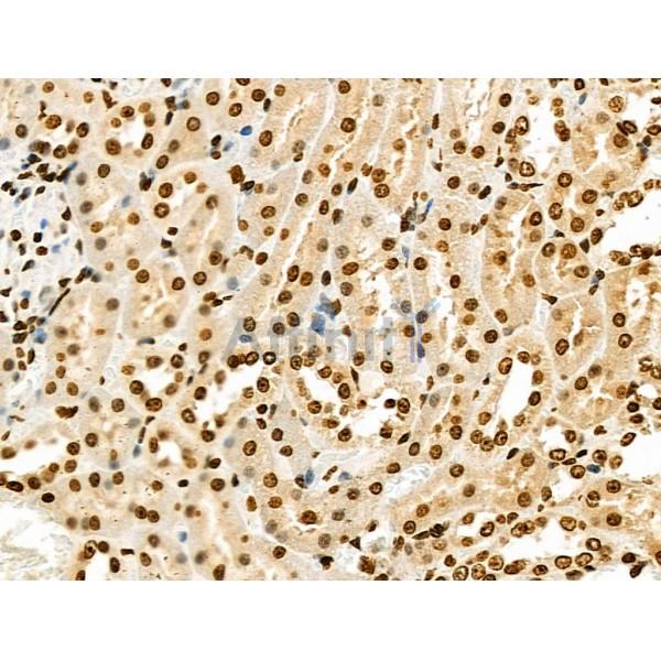 USP30 Antibody - DF4590 at 1/100 staining Rat kidney tissue by IHC-P.