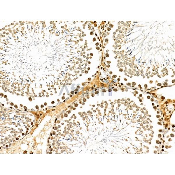 USP30 Antibody - DF4590 at 1/100 staining Rat testis tissue by IHC-P.