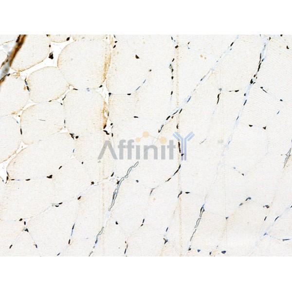 USP30 Antibody - DF4590 at 1/100 staining Rat muscle tissue by IHC-P.