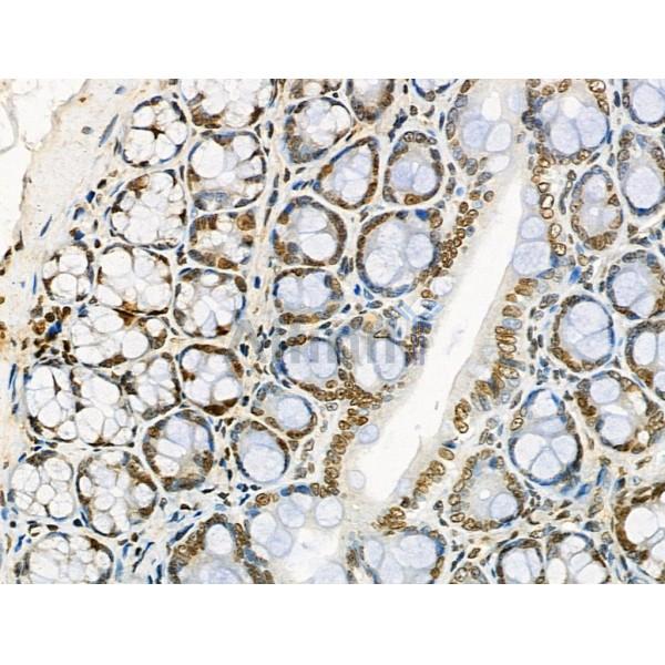 UBAP2L Antibody - DF4599 at 1/100 staining Rat stomach tissue by IHC-P.