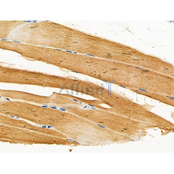 CACNG1 Antibody - DF4612 at 1/100 staining Mouse muscle tissue by IHC-P.