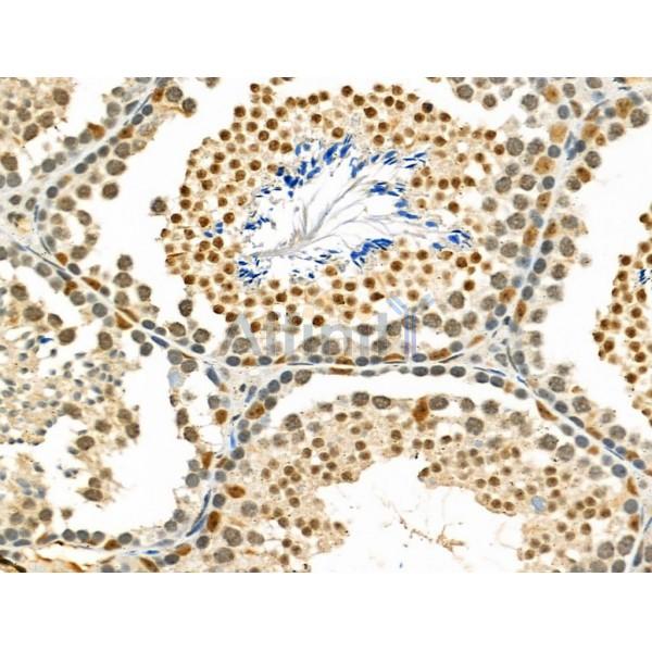 ZSCAN22 Antibody - DF4621 at 1/100 staining Mouse testis tissue by IHC-P.