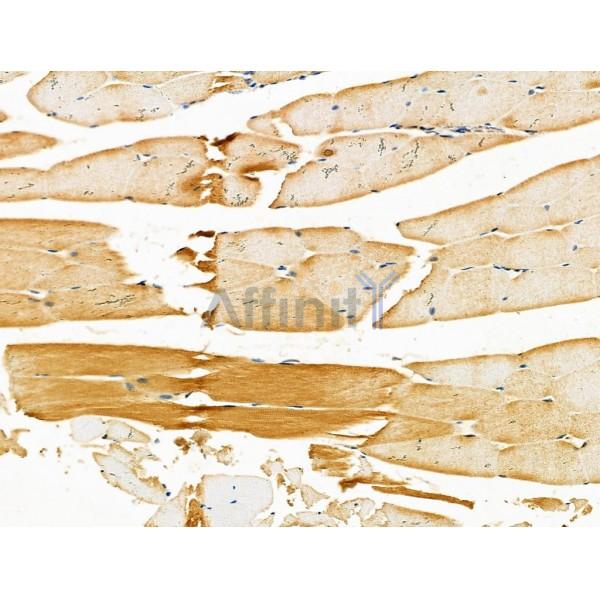 ZP4 Antibody - DF4642 at 1/100 staining Mouse muscle tissue by IHC-P.