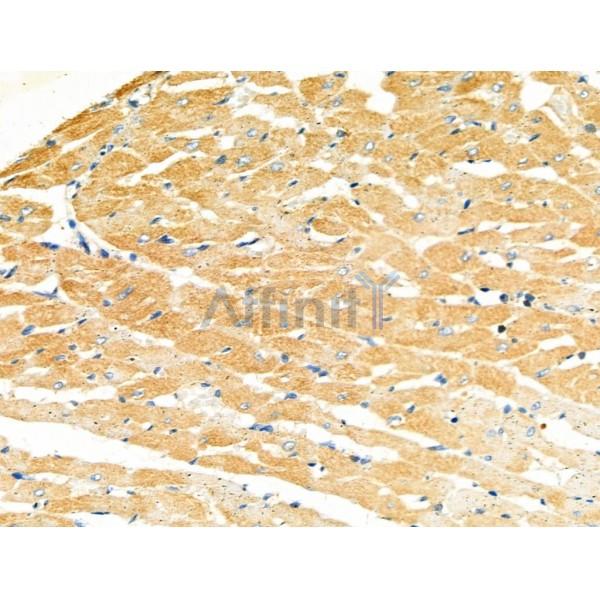 MYL3 Antibody - DF4717 at 1/100 staining Rat heart tissue by IHC-P.
