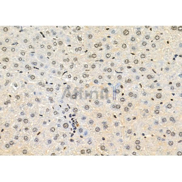 TAIP-2 Antibody - DF4726 at 1/100 staining Mouse liver tissue by IHC-P.