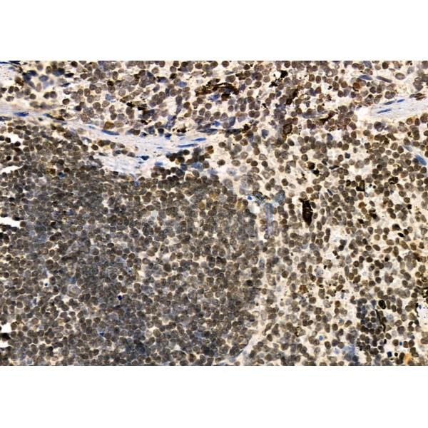 TAIP-2 Antibody - DF4726 at 1/100 staining Mouse spleen tissue by IHC-P.