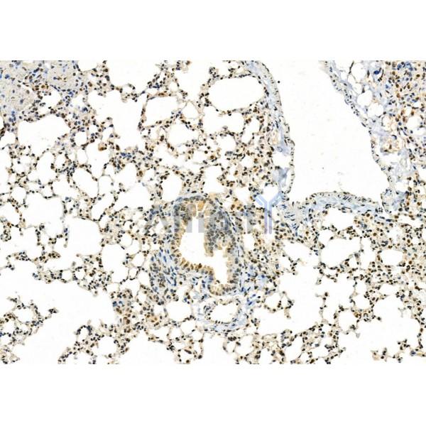 TAIP-2 Antibody - DF4726 at 1/100 staining Mouse lung tissue by IHC-P.
