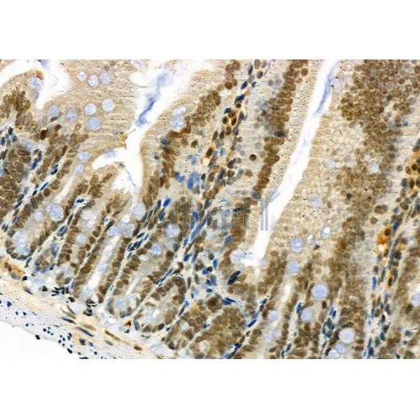 TAIP-2 Antibody - DF4726 at 1/100 staining Mouse colorectal tissue by IHC-P.