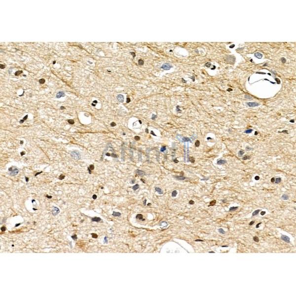 TAIP-2 Antibody - DF4726 at 1/100 staining Rat brain tissue by IHC-P.