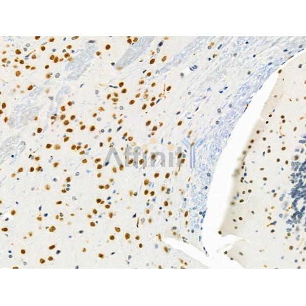 GATA6 Antibody - DF4736 at 1/100 staining Mouse brain tissue by IHC-P.