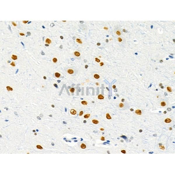 GATA6 Antibody - DF4736 at 1/100 staining Rat brain tissue by IHC-P.