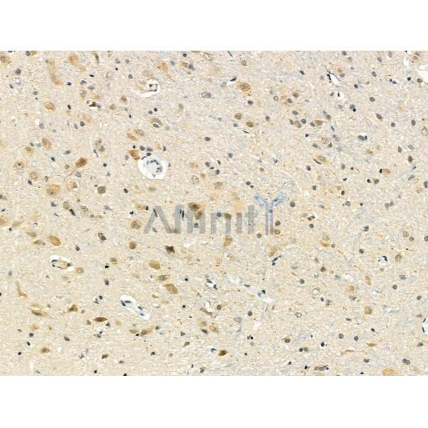 NRF1 Antibody - DF4739 at 1/100 staining Rat brain tissue by IHC-P.
