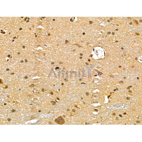 POU4F1 Antibody - DF4771 at 1/100 staining Rat brain tissue by IHC-P.