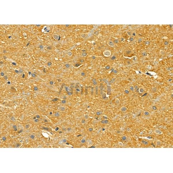 LRP8 Antibody - DF4798 at 1/100 staining Rat brain tissue by IHC-P.