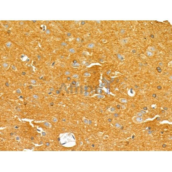 INA Antibody - DF4833 at 1/100 staining Rat brain tissue by IHC-P.