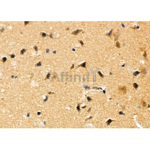 ADORA2A Antibody - DF4850 at 1/100 staining Mouse brain tissue by IHC-P.