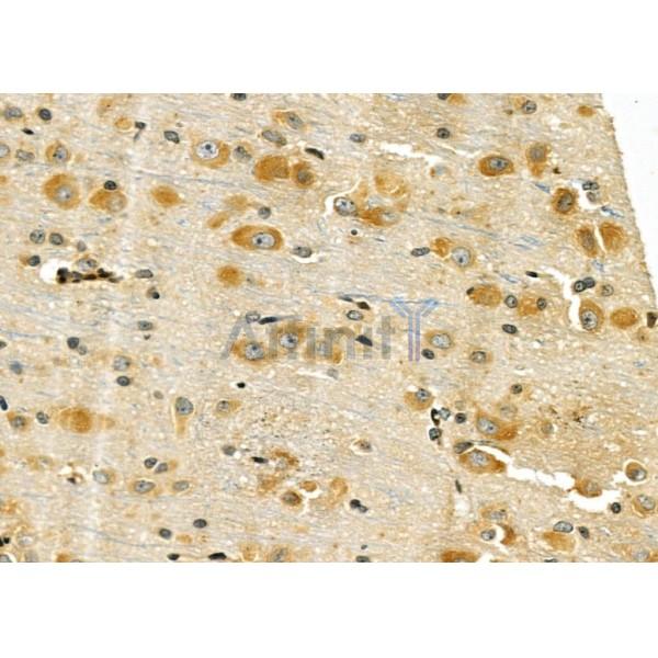 GPR176 Antibody - DF4887 at 1/100 staining Rat brain tissue by IHC-P.
