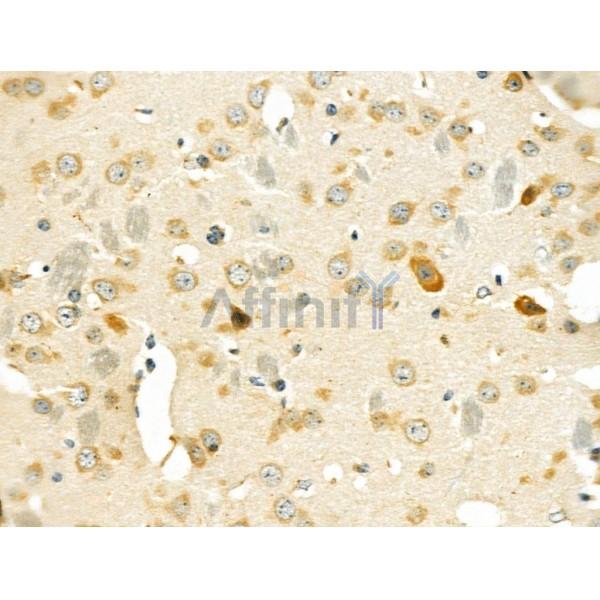ETBR2 Antibody - DF4926 at 1/100 staining Mouse brain tissue by IHC-P.