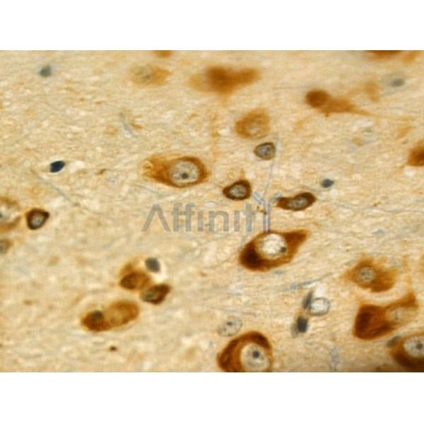 ETBR2 Antibody - DF4926 at 1/100 staining Rat brain tissue by IHC-P.