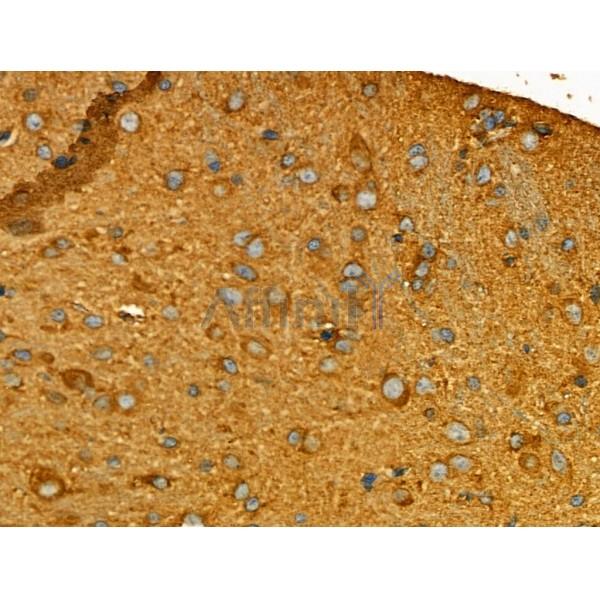 GPR101 Antibody - DF4938 at 1/100 staining Mouse testis tissue by IHC-P.