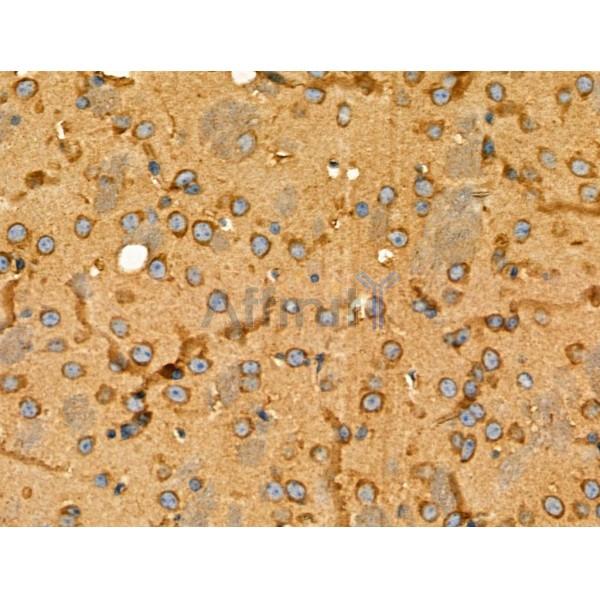 GPR101 Antibody - DF4938 at 1/100 staining Rat spleen tissue by IHC-P.