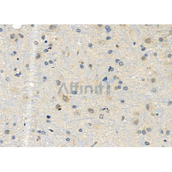 GPR153 Antibody - DF4954 at 1/100 staining Rat brain tissue by IHC-P.