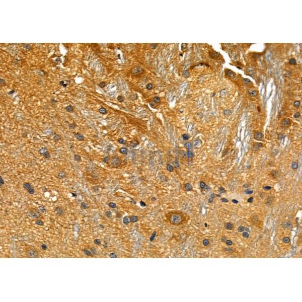 GPR34 Antibody - DF4972 at 1/100 staining Rat brain tissue by IHC-P.