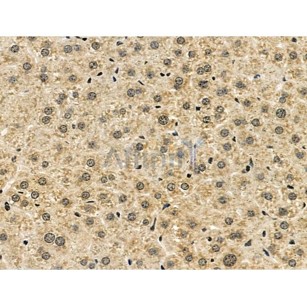 NUDT6 Antibody - DF6063 at 1/100 staining Mouse liver tissue by IHC-P.