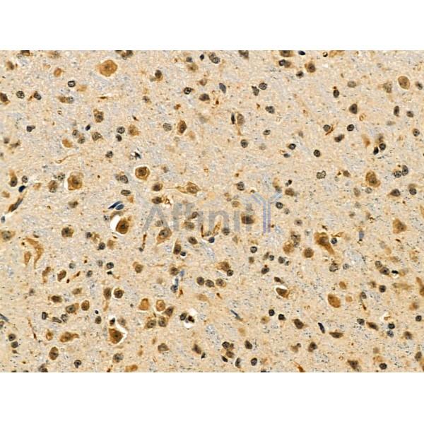 NUDT6 Antibody - DF6063 at 1/100 staining Mouse brain tissue by IHC-P.