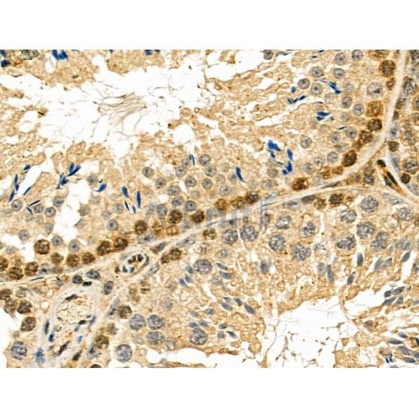 NUDT6 Antibody - DF6063 at 1/100 staining Mouse testis tissue by IHC-P.