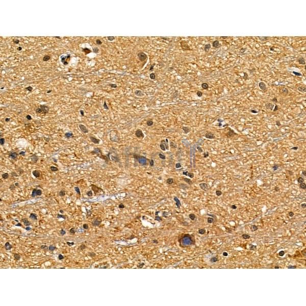 NUDT6 Antibody - DF6063 at 1/100 staining Rat brain tissue by IHC-P.