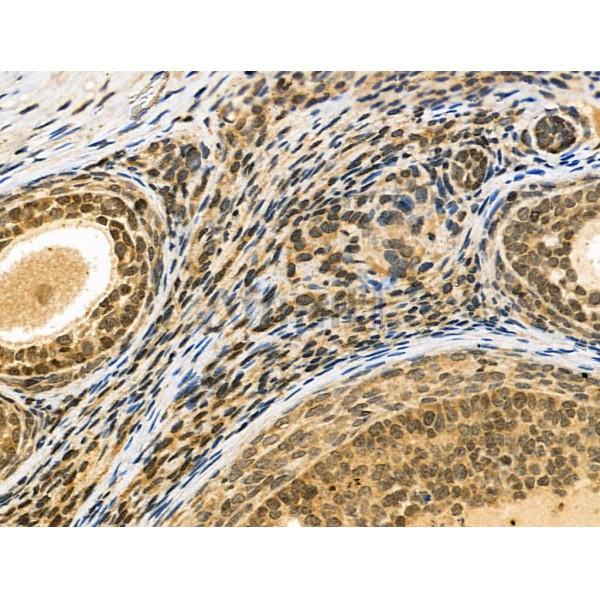 NUDT6 Antibody - DF6063 at 1/100 staining Rat ovarian tissue by IHC-P.