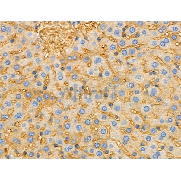 TREM1 Antibody - DF6091 at 1/100 staining Rat liver tissue by IHC-P.