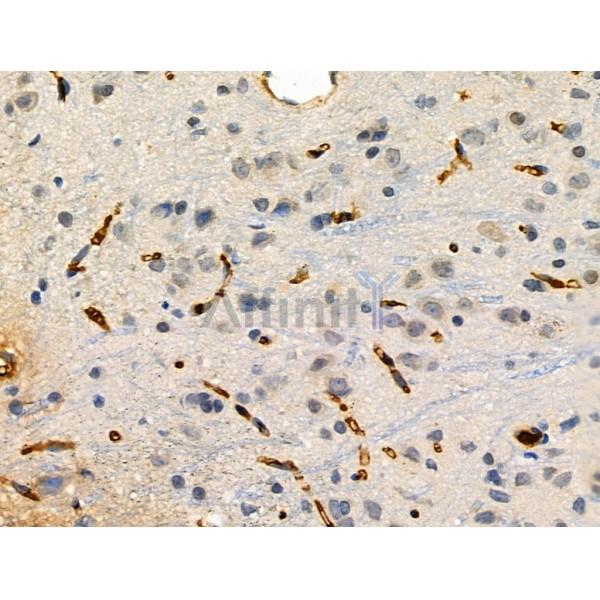TREM1 Antibody - DF6091 at 1/100 staining Rat brain tissue by IHC-P.