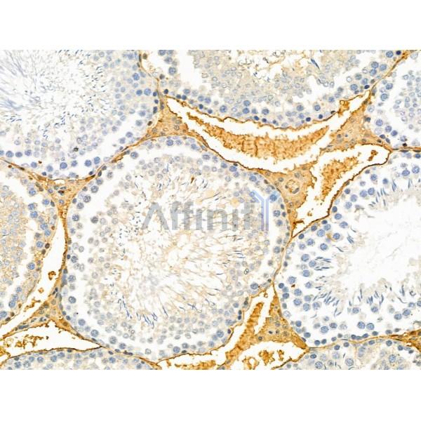 TREM1 Antibody - DF6091 at 1/100 staining Rat testis tissue by IHC-P.