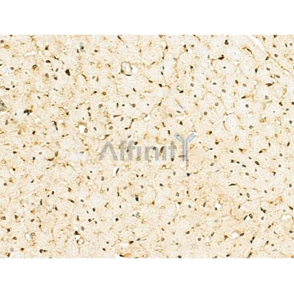 SIRT7 Antibody - DF6161 at 1/100 staining Rat heart tissue by IHC-P.