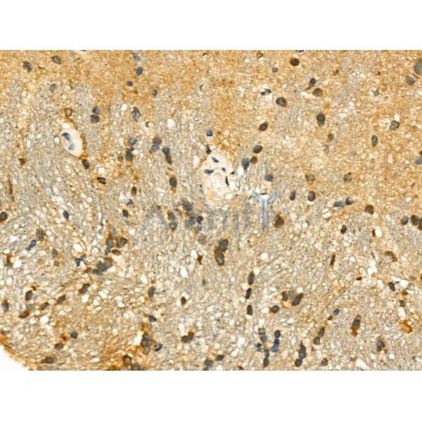 SIRT7 Antibody - DF6161 at 1/100 staining Rat brain tissue by IHC-P.