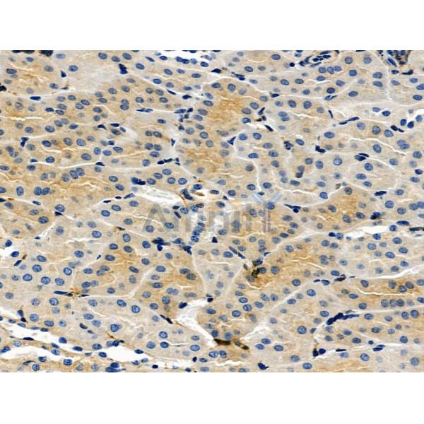 ARF6 Antibody - DF6170 at 1/100 staining Mouse kidney tissue by IHC-P.