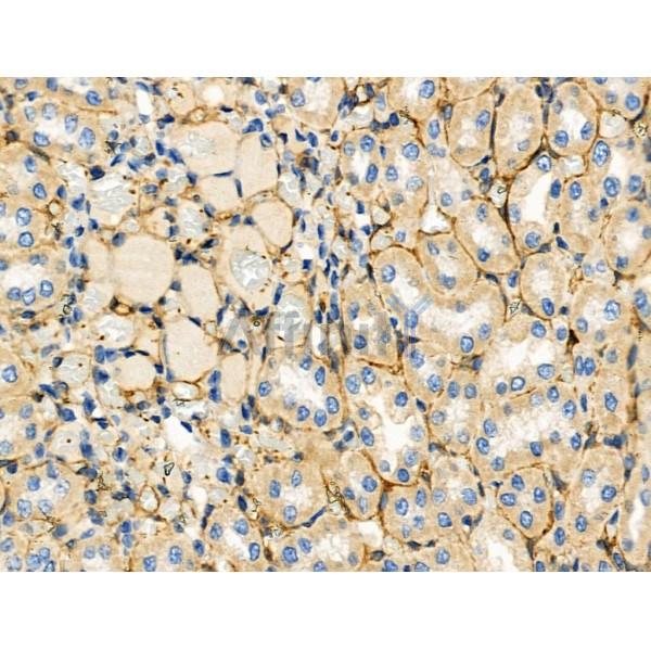 ARF6 Antibody - DF6170 at 1/100 staining Rat kidney tissue by IHC-P.
