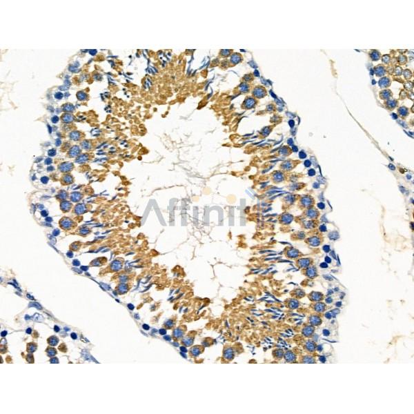 ARF6 Antibody - DF6170 at 1/100 staining Rat testis tissue by IHC-P.