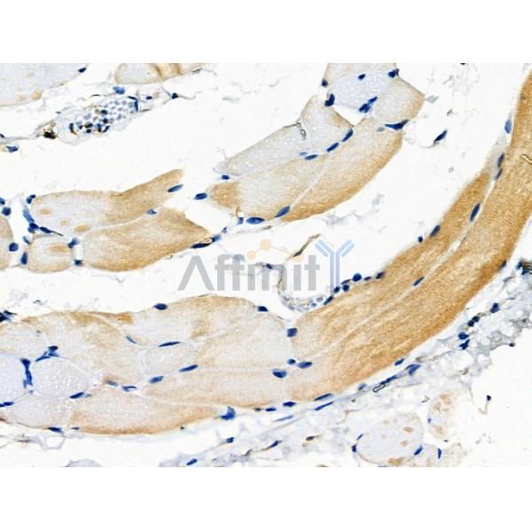 Hexokinase II Antibody - DF6176 at 1/100 staining Rat skin tissue by IHC-P.