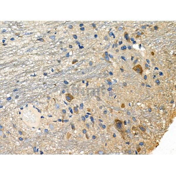 NCK1 Antibody - DF6181 at 1/100 staining Rat brain tissue by IHC-P.