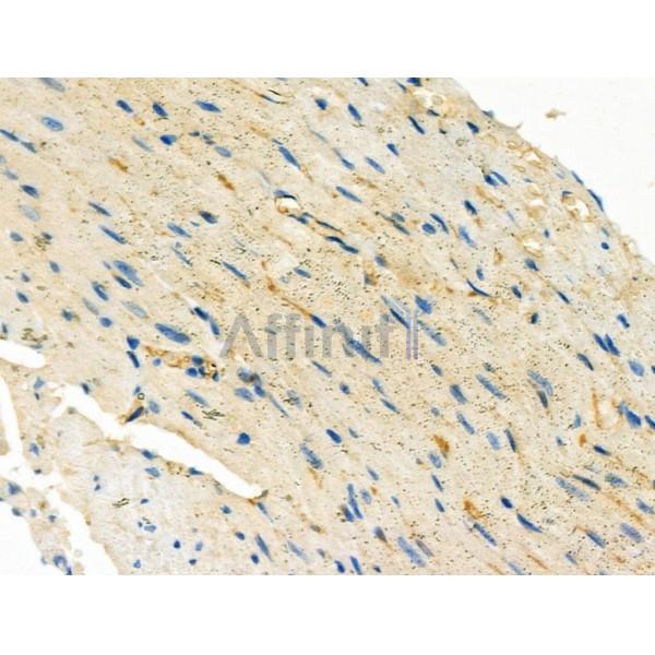 EDN3 Antibody - DF6194 at 1/100 staining Mouse heart tissue by IHC-P.