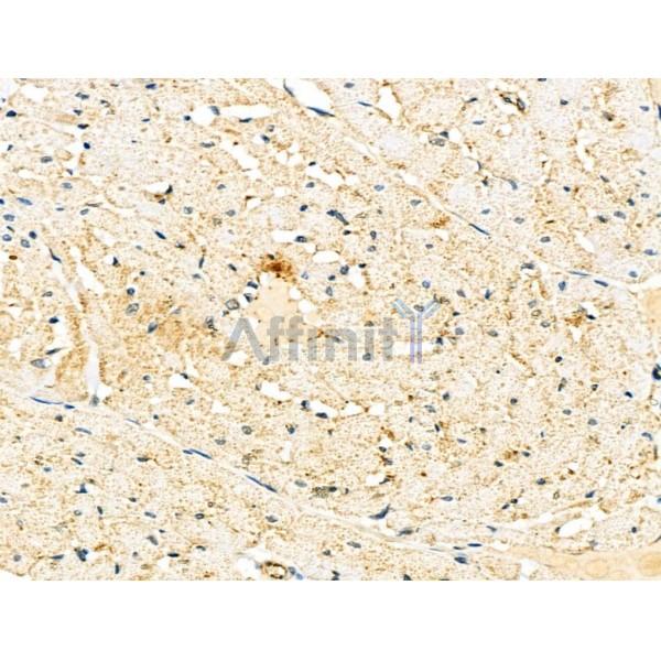 EDN3 Antibody - DF6194 at 1/100 staining Rat heart tissue by IHC-P.