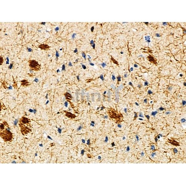 CYR61/CCN1 Antibody - DF6250 at 1/100 staining Mouse brain tissue by IHC-P.