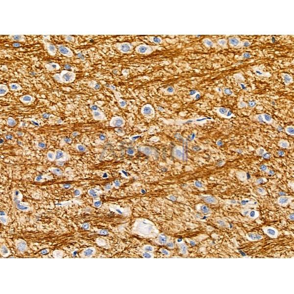 CYR61/CCN1 Antibody - DF6250 at 1/100 staining Rat brain tissue by IHC-P.