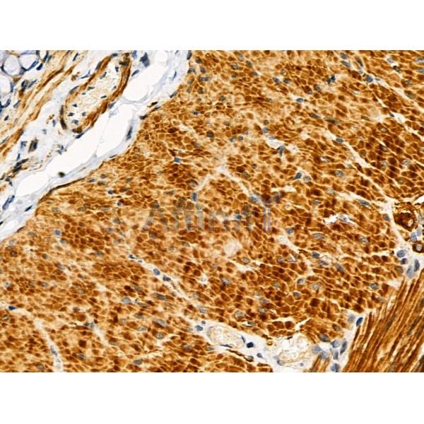CYR61/CCN1 Antibody - DF6250 at 1/100 staining Rat stomach tissue by IHC-P.