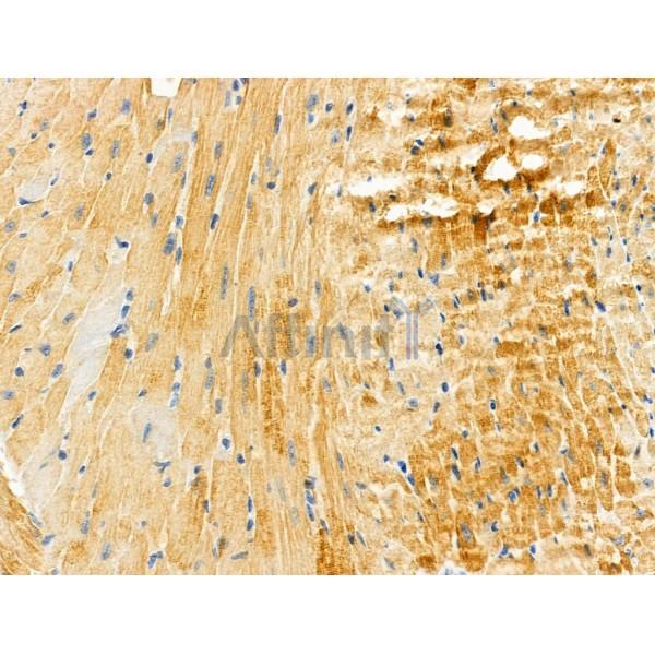 TNNT2 Antibody - DF6261 at 1/100 staining Mouse heart tissue by IHC-P.