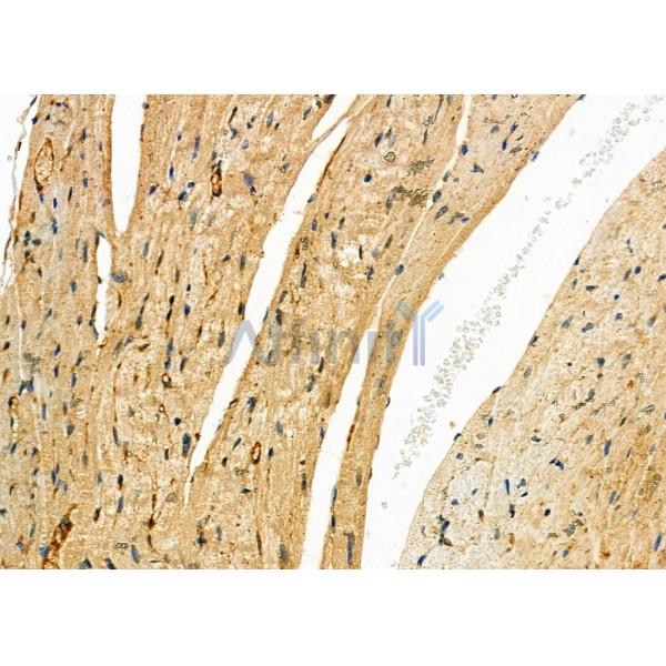 LDHA Antibody - DF6280 at 1/100 staining Mouse heart tissue by IHC-P.